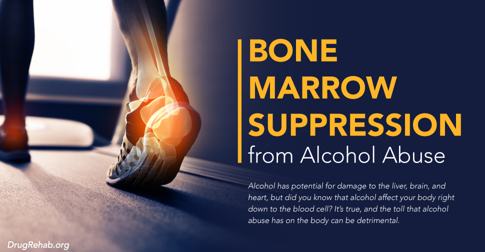 DrugRehab.org Bone Marrow Suppression from Alcohol Abuse