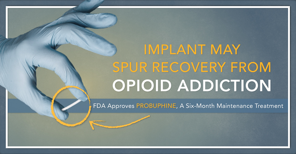Implant May Spur Recovery from Opioid Addiction