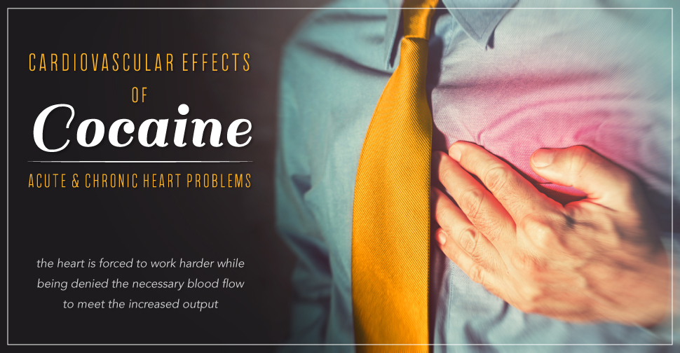 DrugRehab.org Cardiovascular Effects of Cocaine - Acute and Chronic Heart Problems