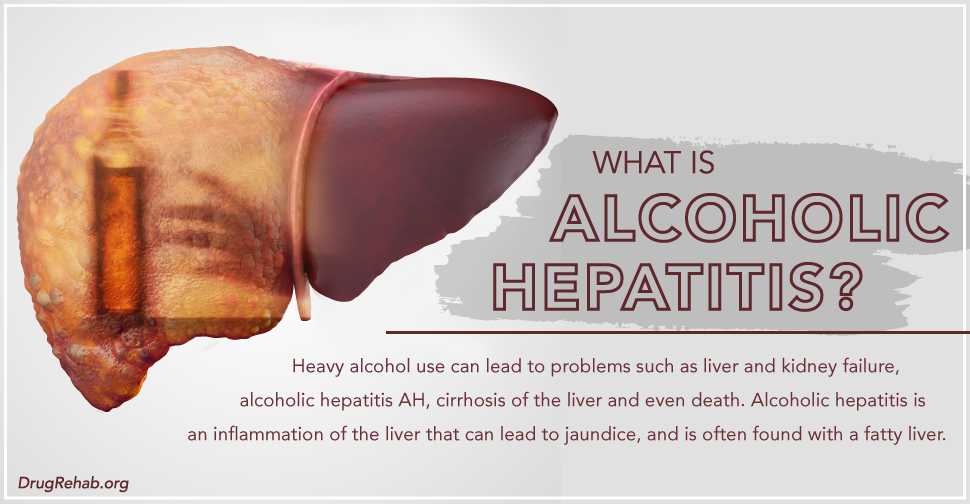 DrugRehab.org What is Alcoholic Hepatitis_