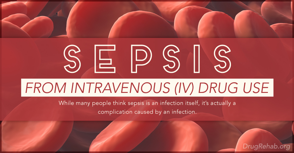 DrugRehab.org Sepsis From Intravenous (IV) Drug Use